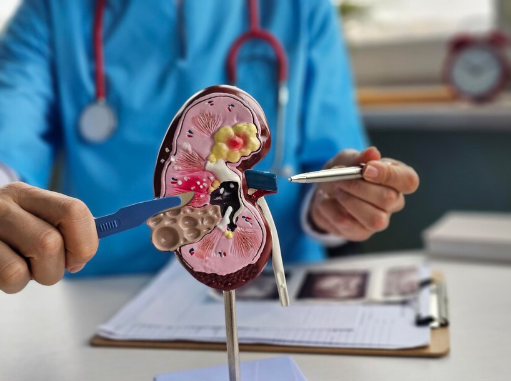 kidney transplant in Bangalore