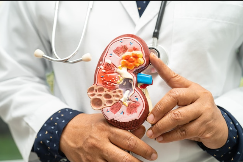 kidney transplant in Bangalore
